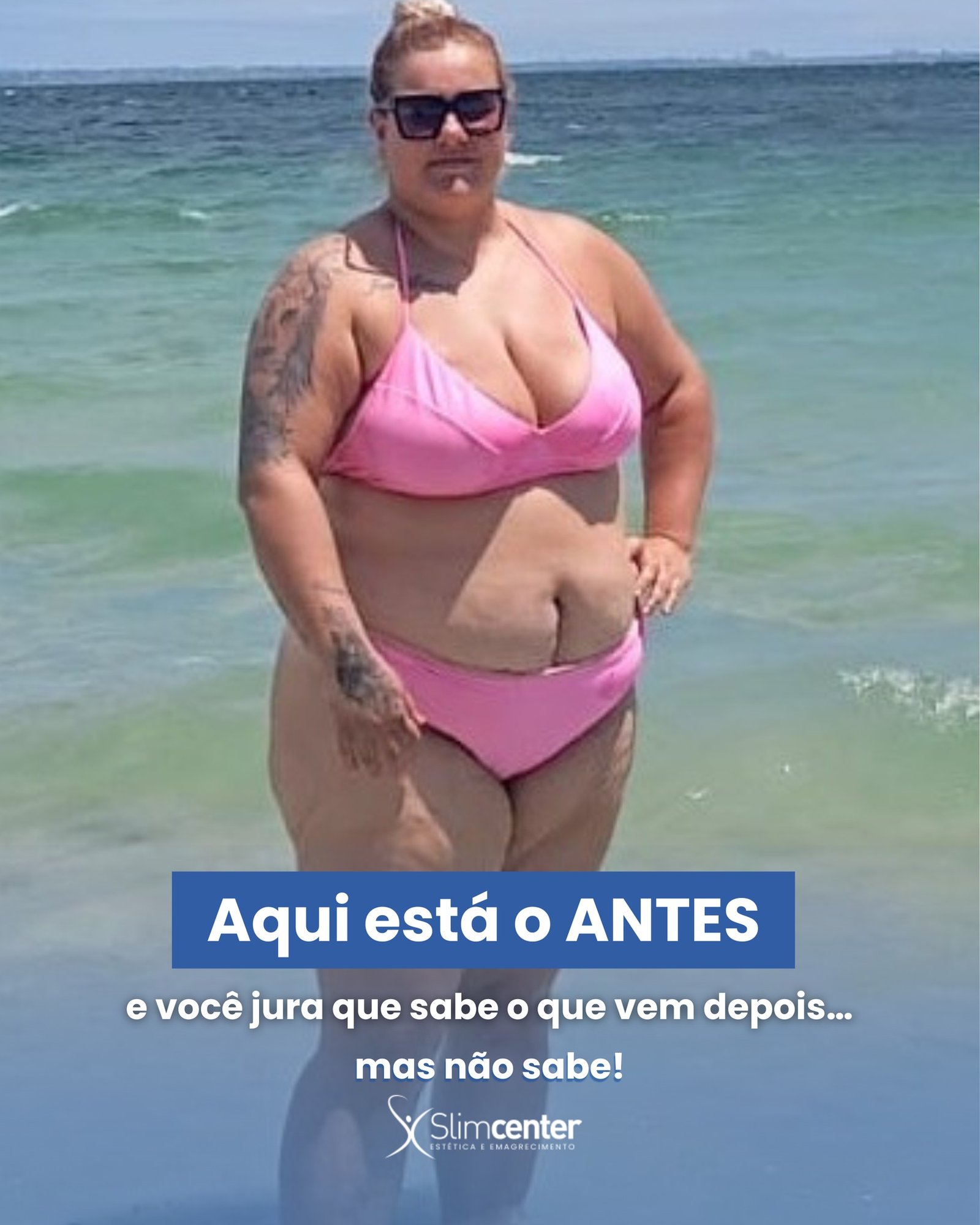 Registro anterior de uma paciente da Slim Center Mooca, em traje rosa na praia
